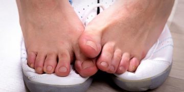 5 cách loại bỏ mùi hôi chân