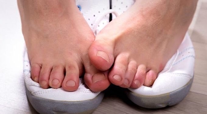 5 cách loại bỏ mùi hôi chân