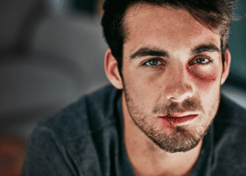 Chấn thương tâm lý của người chồng bị vợ bạo hành