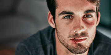 Chấn thương tâm lý của người chồng bị vợ bạo hành