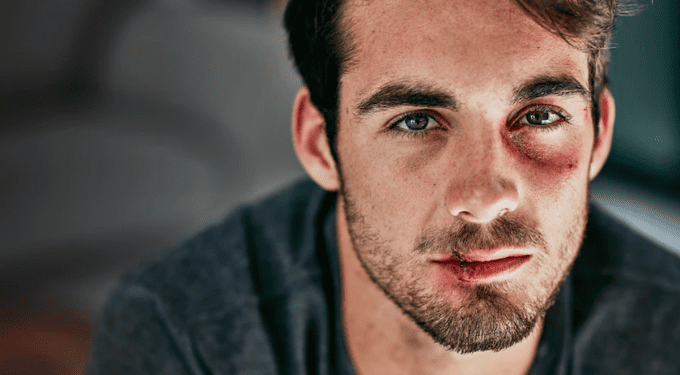 Chấn thương tâm lý của người chồng bị vợ bạo hành