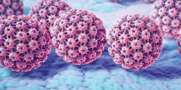 Mất hàng chục triệu đồng chữa sùi mào gà